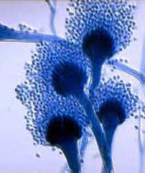 ASPERGILLUS